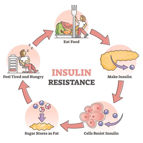 smelly insulin resistance in obesity and type 2 diabetes mellitus